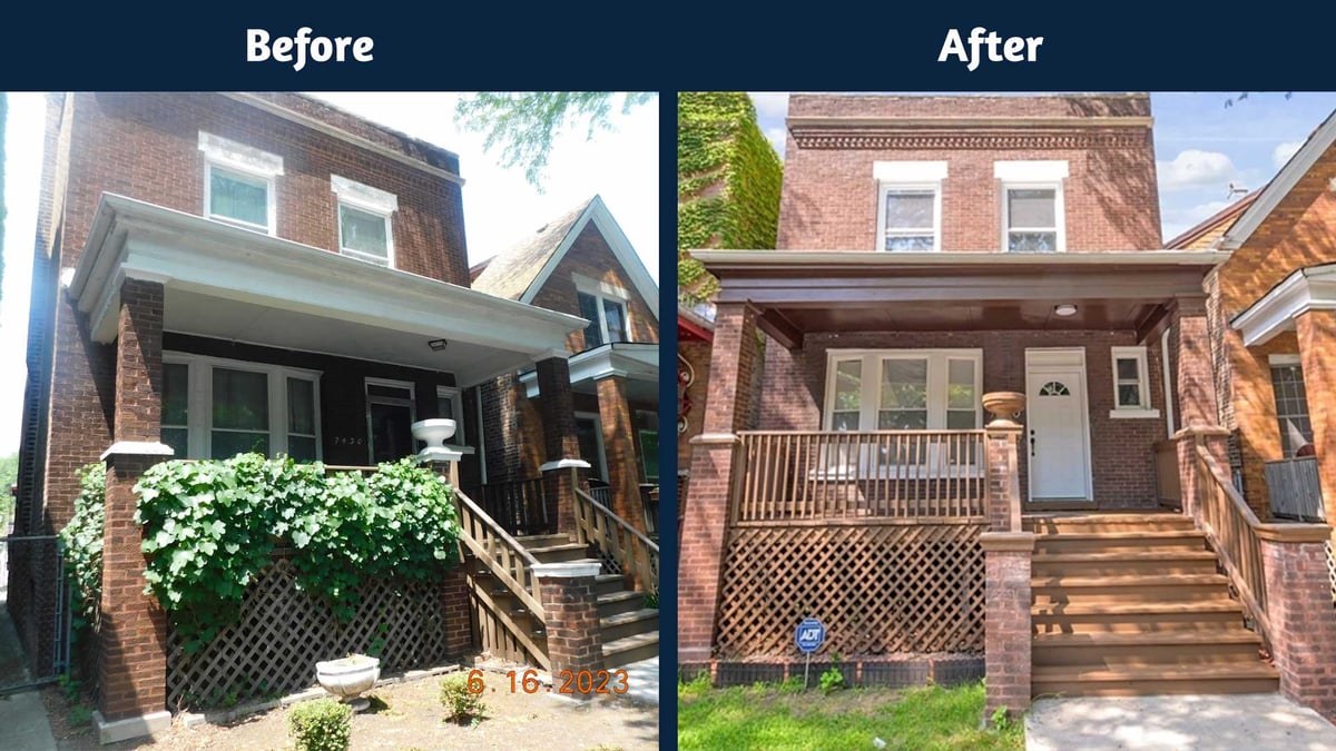 Before-After-Front-7430SKingDr